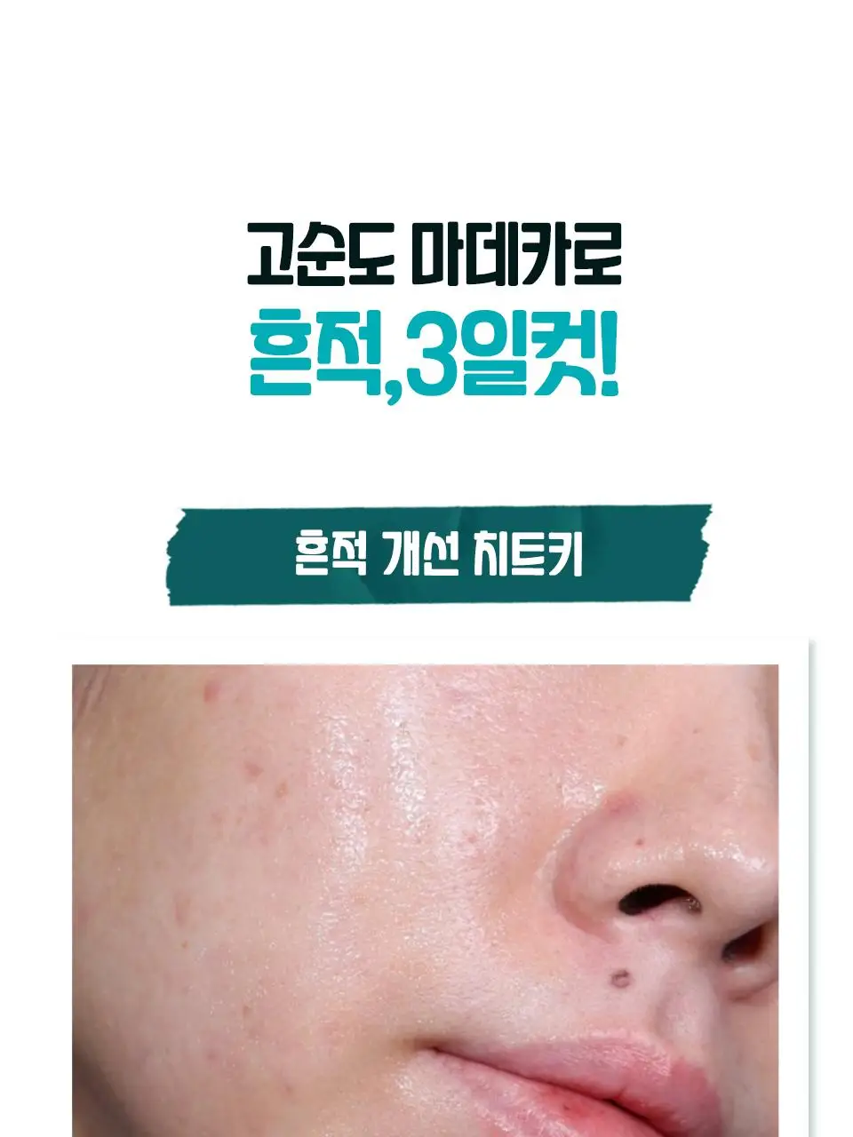 [대용량/흔적리셋] 아이소이 브라이트닝 카밍 스팟 세럼 35ml 리필 기획(+35ml) 상세페이지 5
